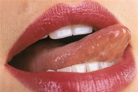 湿气重舌头是什么样