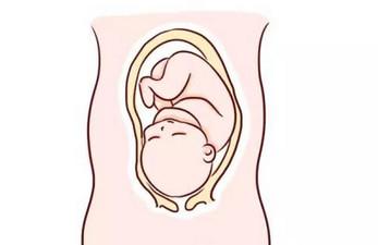 胎位不正可以顺产么？它的危害有哪些？