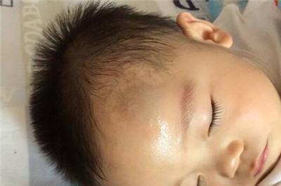 宝宝经常摔到头会影响智力吗