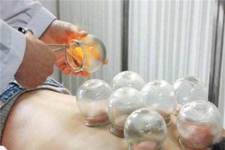 湿气重拔罐拔哪里