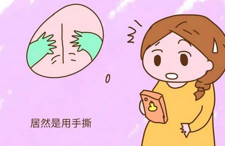 知道剖腹产是用手“撕”开的，你还敢这样生？