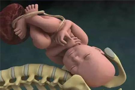 脐带扭转和睡姿有关吗