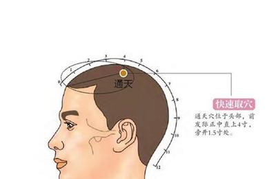 宝宝流鼻涕艾灸哪里