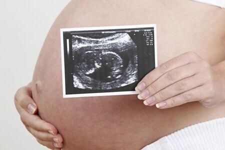 孕囊大小看男女的公式