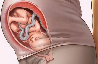 产妇分娩时，胎儿是这样从产道出生的！