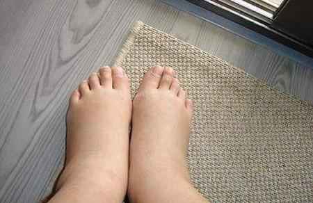 怀孕期间腿脚浮肿怎么办？过来人经验教你轻松缓解