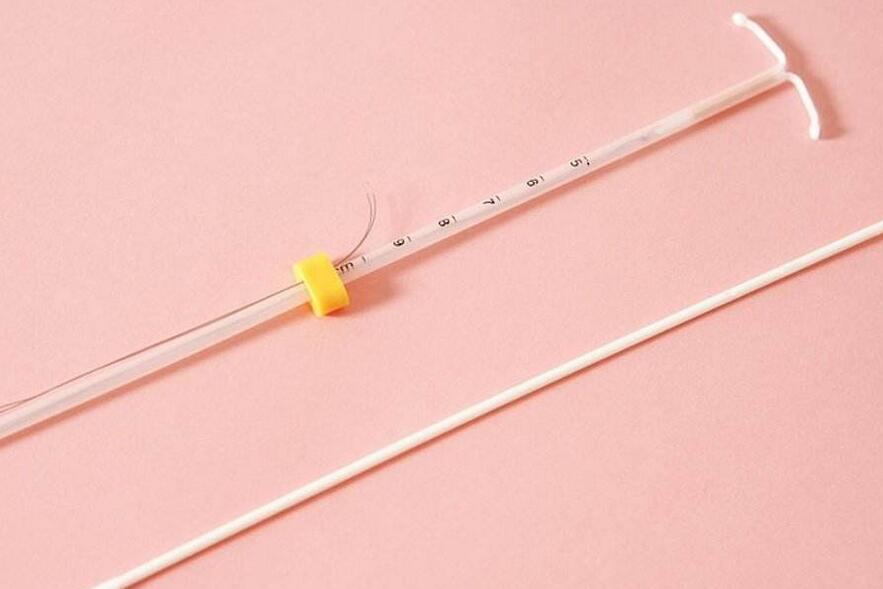 婴儿握避孕环出生 究竟是怎么回事