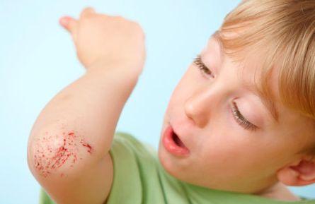 幼儿容易发生的意外伤害有哪些