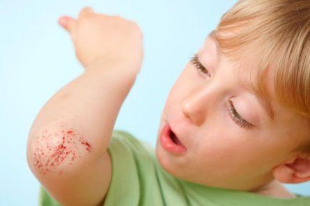 幼儿容易发生的意外伤害有哪些