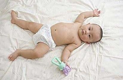 新生儿脐疝是个什么症状？快对照自家宝宝看看！