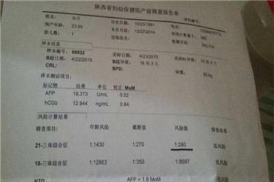 唐氏结果怎么看男女