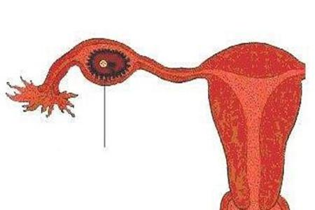 输卵管不通的症状有哪些 输卵管堵塞症状一览表