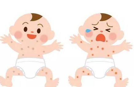 这些防治宝宝湿疹的小偏方你用过吗？