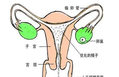 输卵管堵塞能排卵吗 输卵管不孕的那些事儿你真的知道吗?