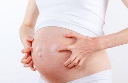 孕妇患上荨麻疹对胎儿有影响吗，要如何护理？