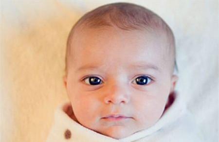 准妈孕期做好这件事可以避免生下“唐氏儿”