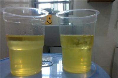 尿液加酒精测男女法图 从尿液一眼看出你生男生女