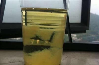 尿液和酒精能测出男孩女孩吗 坑爹的尿液加酒精鉴别胎儿性别