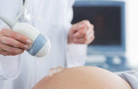 这8种胎儿缺陷B超查不出来