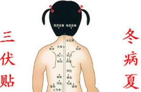 冬病夏治三伏贴管用吗 三伏贴治病是“心理安慰”还是真有效
