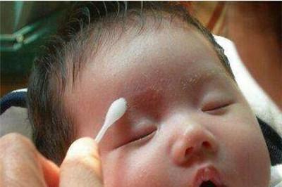 奶藓是什么样子的