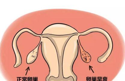 年轻女性也会卵巢早衰吗？？？