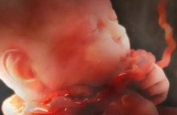 胎儿宫内窒息的3大信号！准妈发现晚胎儿就没命了！
