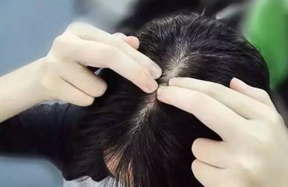 产后大把掉头发，究竟是什么原因？如何才能化解这种尴尬？