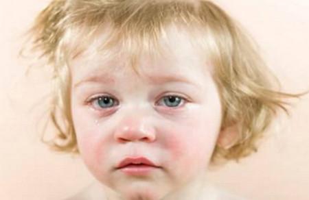 宝宝满身痱子，用爽身粉对吗