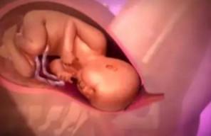 跟剖腹产相比，自然分娩对胎儿和准妈的好处有哪些？