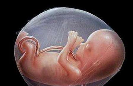 天啊，肚里宝宝被脐带缠住了，该怎么办？