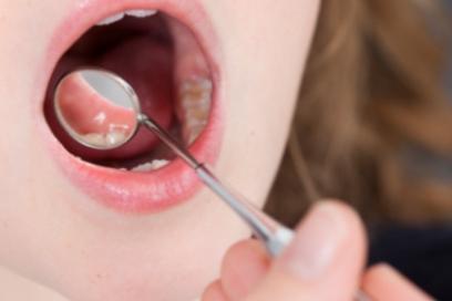 小儿扁桃体发炎发烧推拿图解 宝宝扁桃体发炎反复发烧怎么做推拿