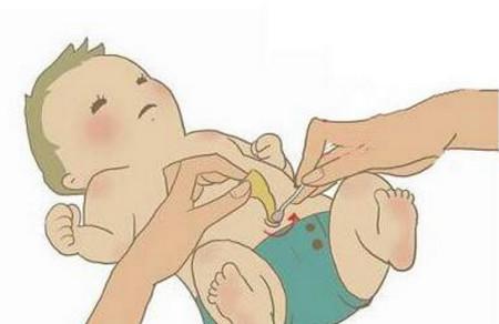 天热护理新生儿 别忽视脐带