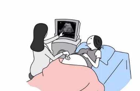 分娩｜孕晚期最怕的就是早产，还不赶紧给自己补补课