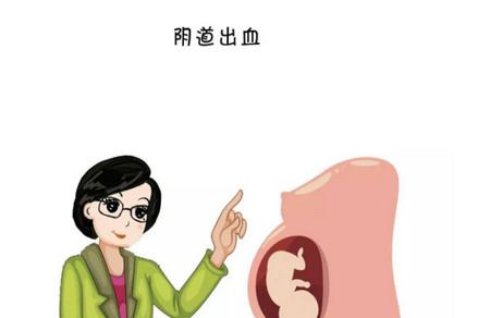 孕期来月经你遇到过吗？用月经来鉴别怀孕靠谱吗？