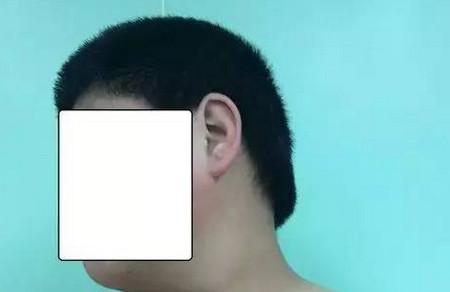12岁男孩脖子突然歪了！就因为你我都干过的这事儿……