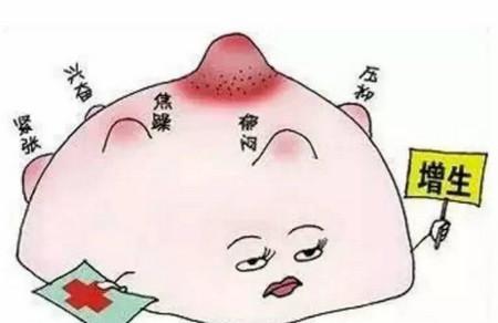 急性乳腺炎不同时期的最佳处理方法