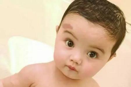 有的宝宝刚刚出生为什么会有胎记? 其实都是因为你孕期做了这些事