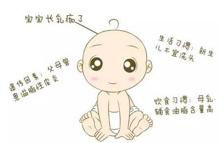 新生宝宝脑袋上有乳痂，洗还是不洗？