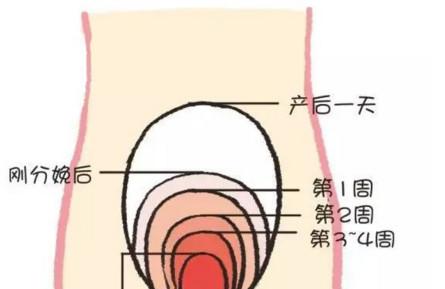 产后瘦身很难，有什么妙招吗？