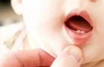 宝宝出牙别着急，吃这6类食物有助于长牙