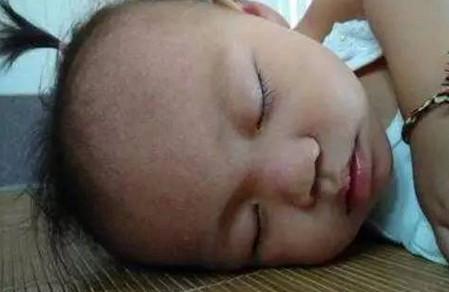 宝宝长痱子难受，治疗宝宝长痱子的6个小妙招
