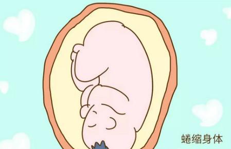 生孩子当天，不仅孕妈妈在努力，肚子里的胎儿也在勇敢地应对危险