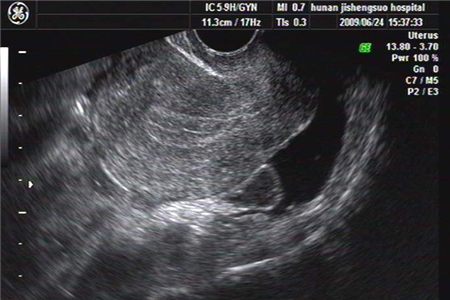 处女怎么做阴超 处女一定要看！