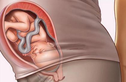 胎儿多少周入盆 胎儿入盆注意事项