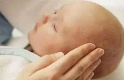影响宝宝“颜值”的乳痂千万别瞎抠