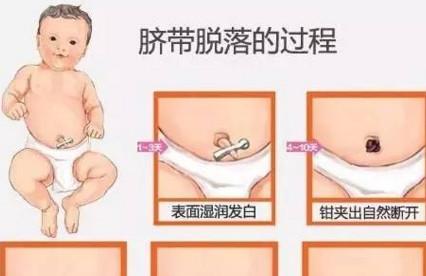宝宝出生后脐带多久脱落？