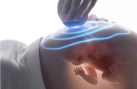 做超声影像（四维彩超）时，如何让胎宝宝翻身配合检查？