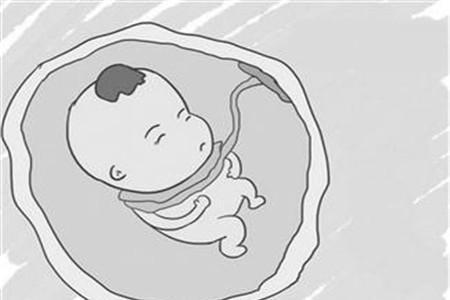 脐带绕颈一周怎么矫正 这些方法帮到你