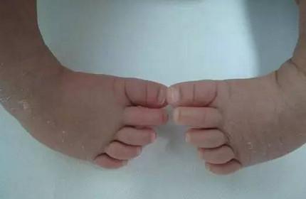 新生宝宝这21种情况不是病，宝妈不要太担心！